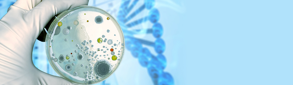 Protein Expression Screening Services